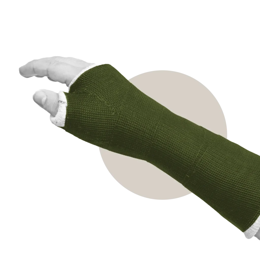 Hand in cast